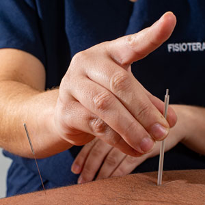Acupuntura