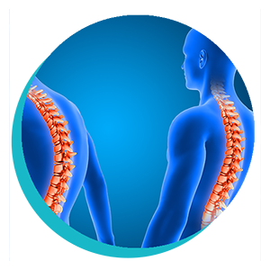 Hipercifose: Compreendendo, Tratando e Recuperando com a Fisioterapia