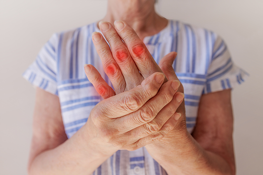 A fisioterapia pode ser uma aliada valiosa no tratamento da Artrite Reumatoide (AR).